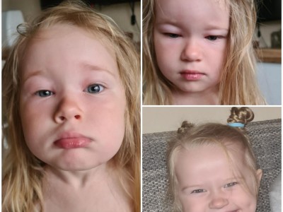 4yearold girl needs help with medical problem