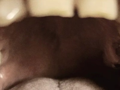 Need help getting full mouth replacement dentures