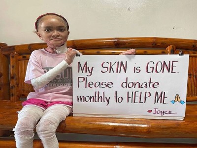 Please Donate To Help Save Joyce's Life And Reduce Her Pain