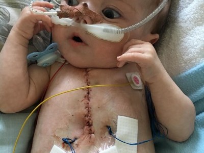 New Born With Heart Disease