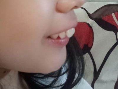 Please help my daughter's teeth